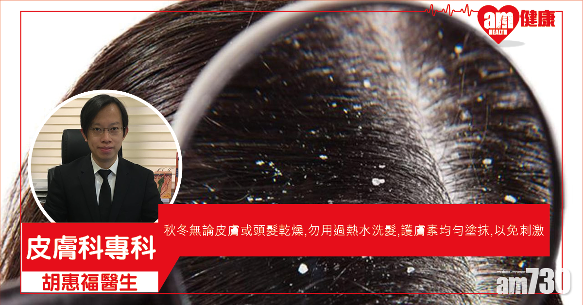 秋冬頭皮多是髮質問題嗎？