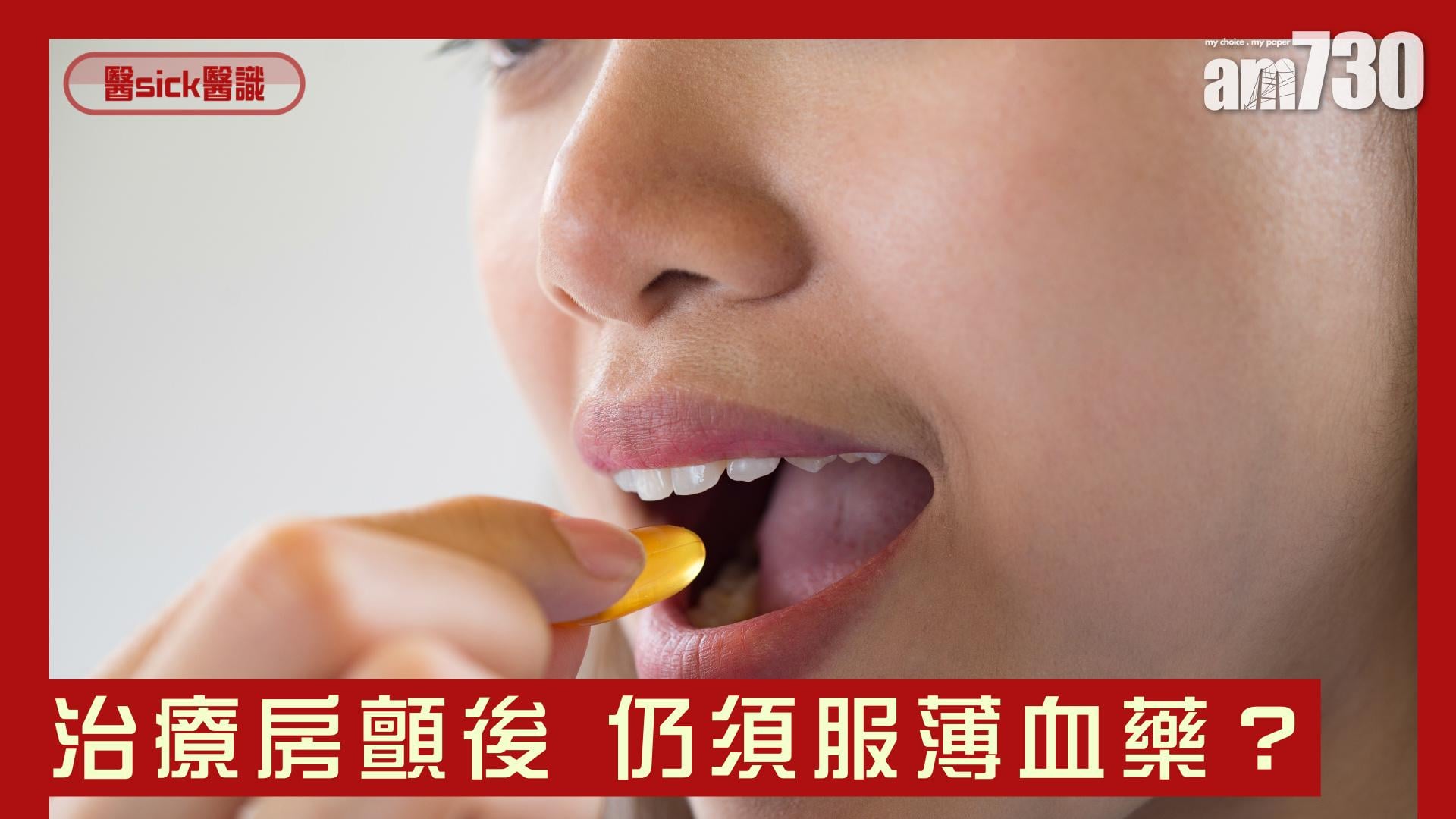 治療房顫後 仍須服薄血藥？