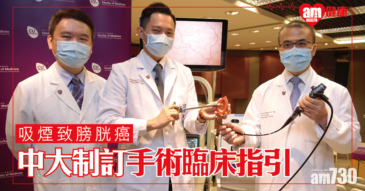 【吸煙致膀胱癌】中大制訂「經尿道膀胱腫瘤整塊切除術」臨床指引