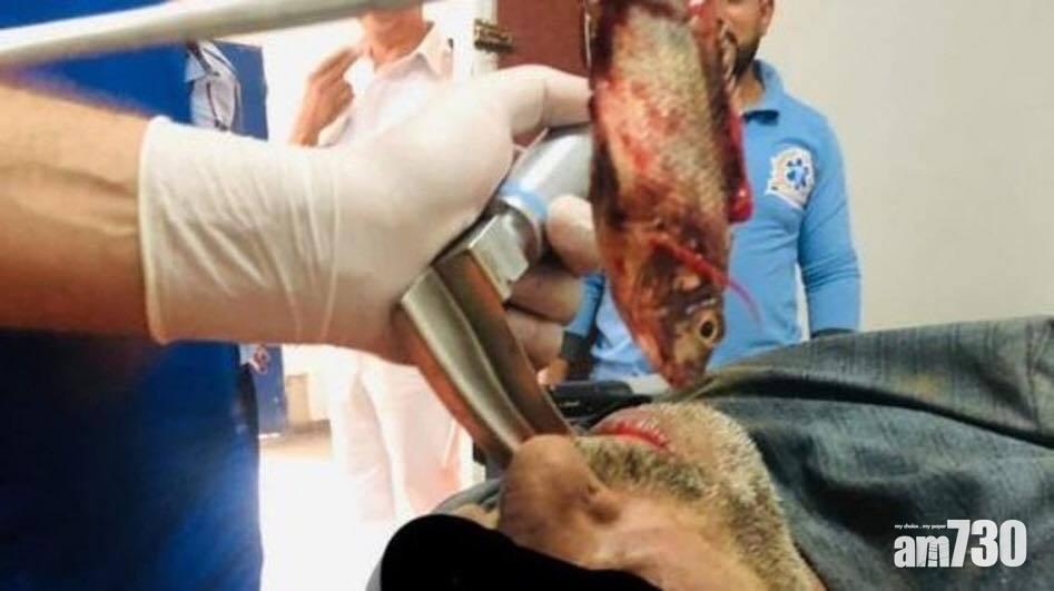 【貪字得個貧】 漁夫捕魚硬塞口中 活魚猛鑽喉嚨險斃命