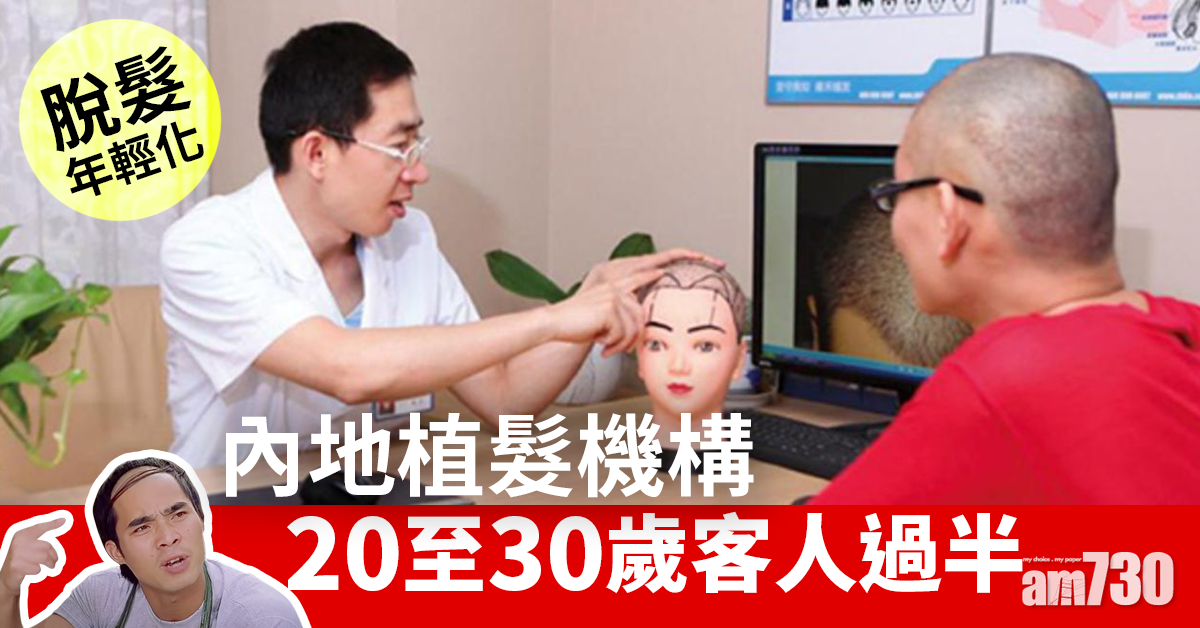 【脫髮年輕化】內地植髮機構20至30歲客人過半