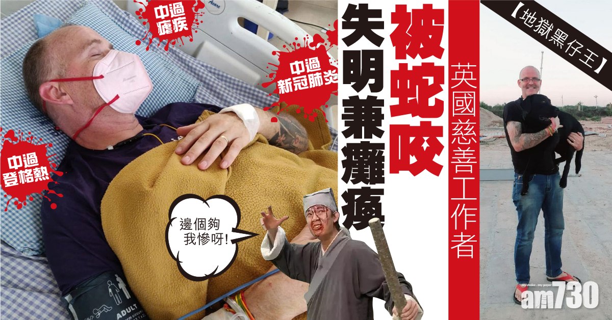 【超級黑仔】英慈善工作者中過瘧疾登格熱新冠肺炎  最近被眼鏡蛇咬失明兼癱瘓