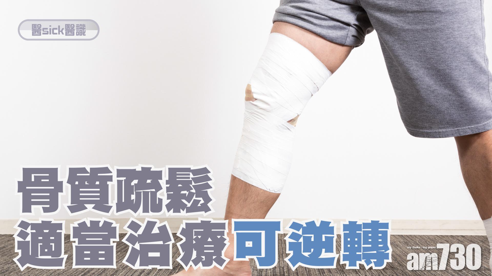 骨質疏鬆 適當治療可逆轉