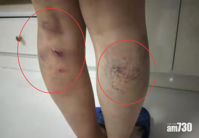 貴州4老師毆打女生 傳校長鼓勵體罰「打死我負責」