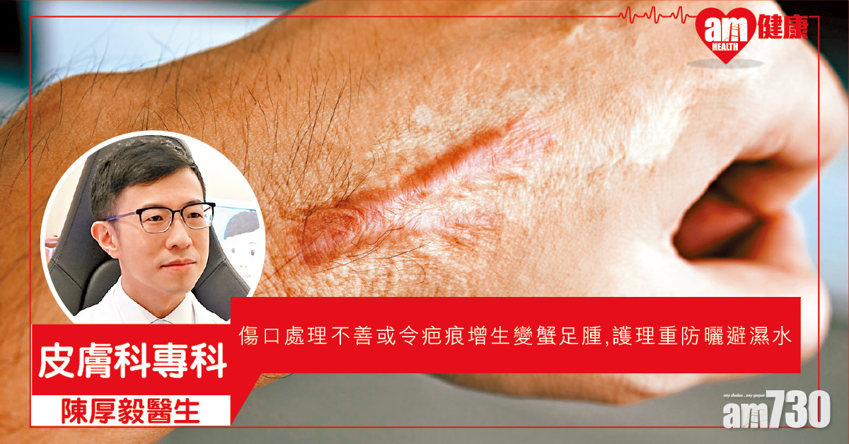 保護傷口 避免疤痕增生