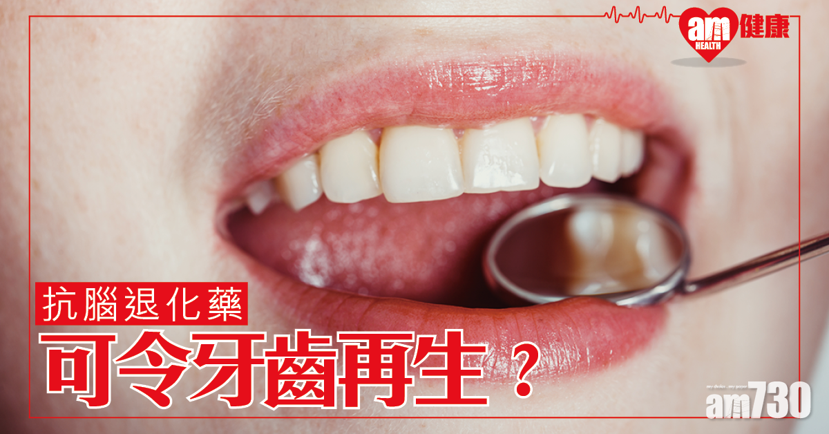研究：抗腦退化藥或可令牙齒再生