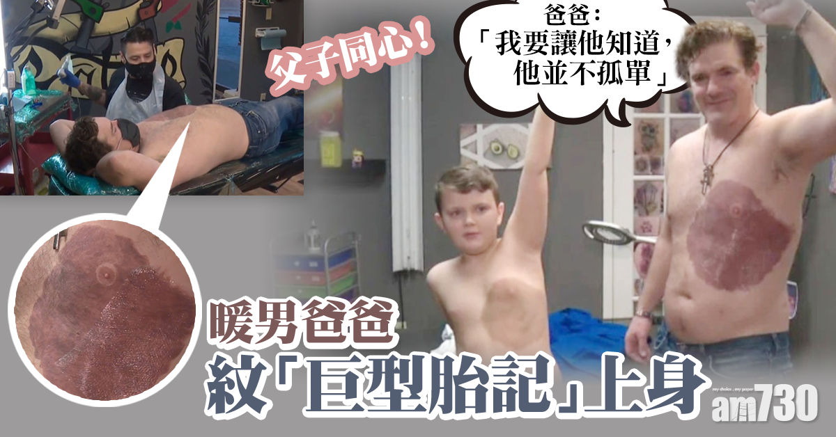 【網上熱話】暖男爸爸紋「巨型胎記」上身 安慰兒子心靈