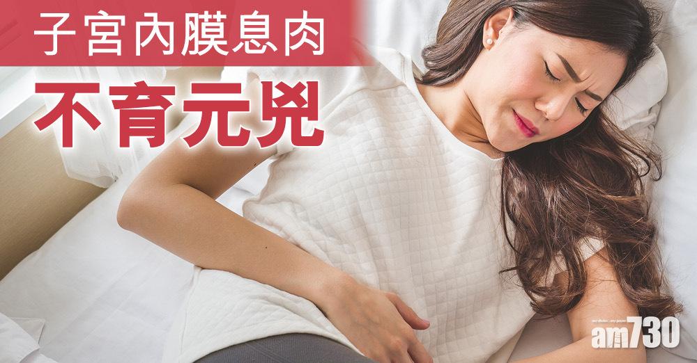 子宮內膜息肉：不育元兇