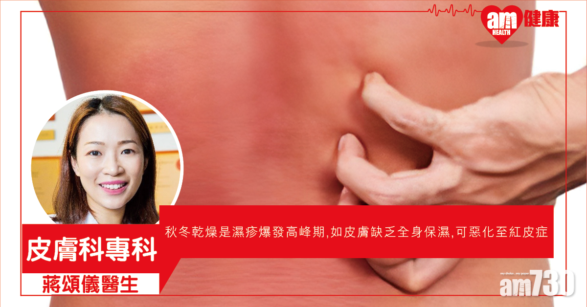 做好保濕  防濕疹惡化變紅皮症