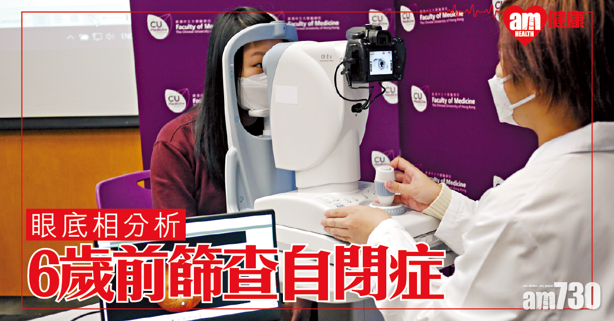 眼底相助6歲前篩查自閉症