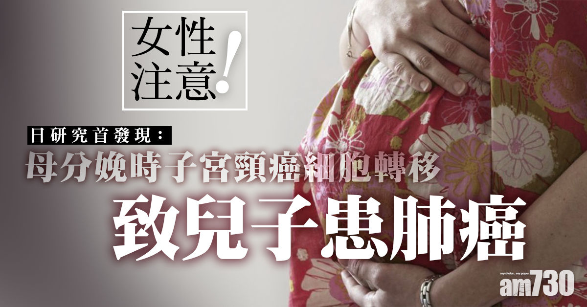 日研究首發現：母分娩時子宮頸癌細胞轉移 致兒子患肺癌