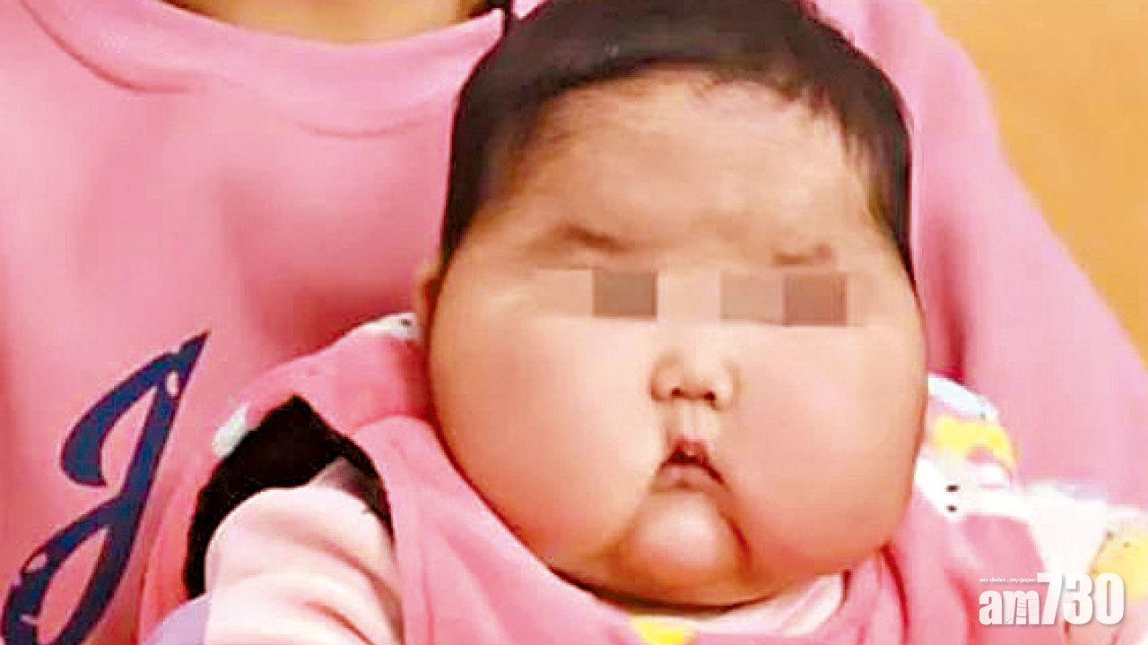 「大頭嬰兒」抑菌霜證含激素 警調查