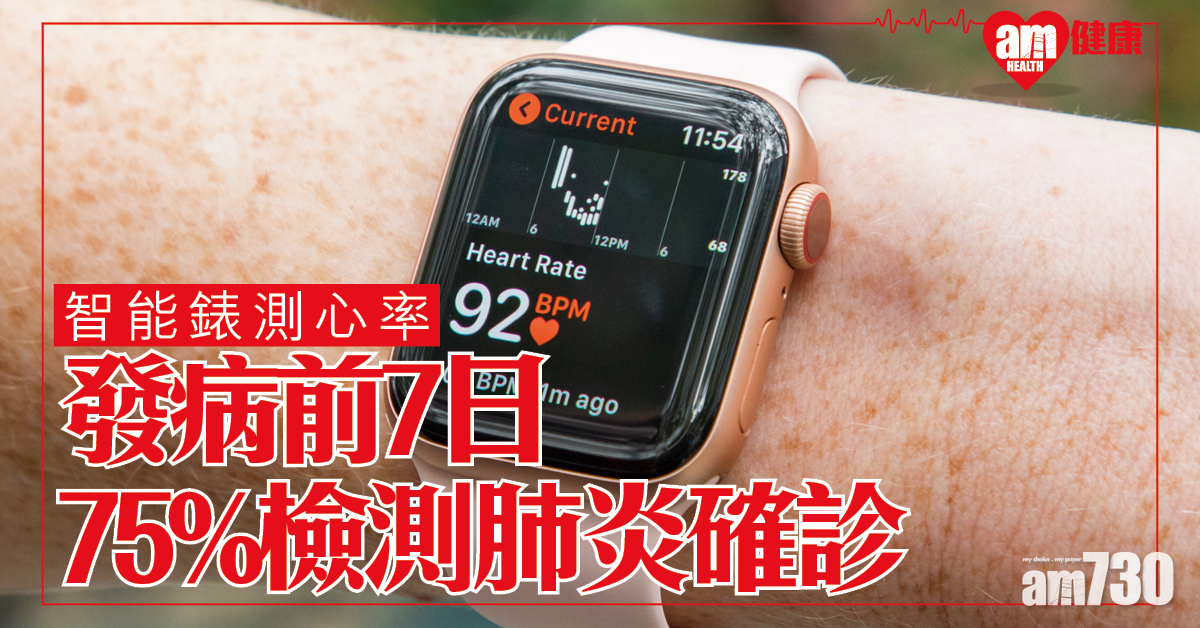 【新冠肺炎】研究指Apple Watch能於發病前7日 偵測確診者準確度達75%