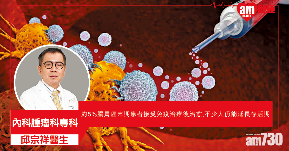 對付腸胃癌 免疫治療成趨勢