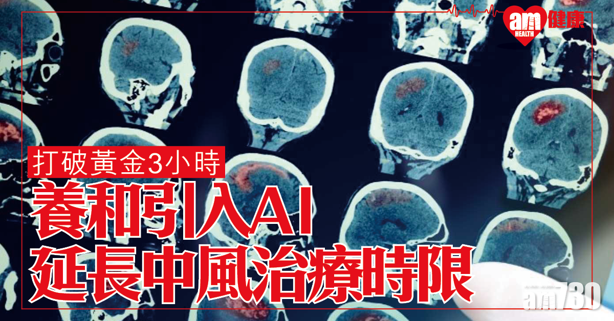 打破黃金3小時│養和引入RapidAI 延長中風治療時限
