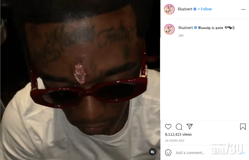 Lil Uzi Vert四圍晒額頭巨鑽