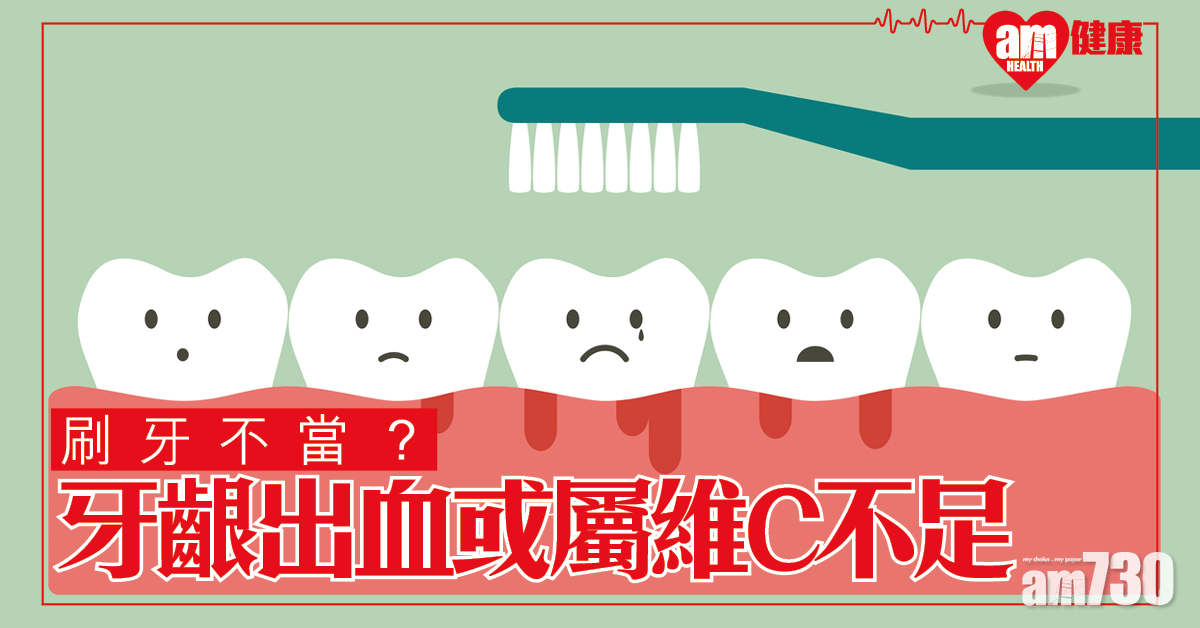 以為刷牙不當？牙齦出血可能是維他命C不足