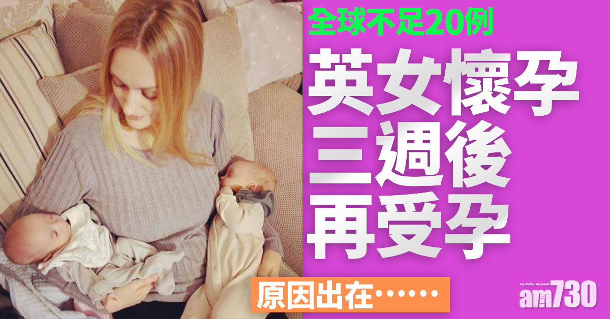 世上罕見｜英女懷孕三週後再受孕 全球不足20例