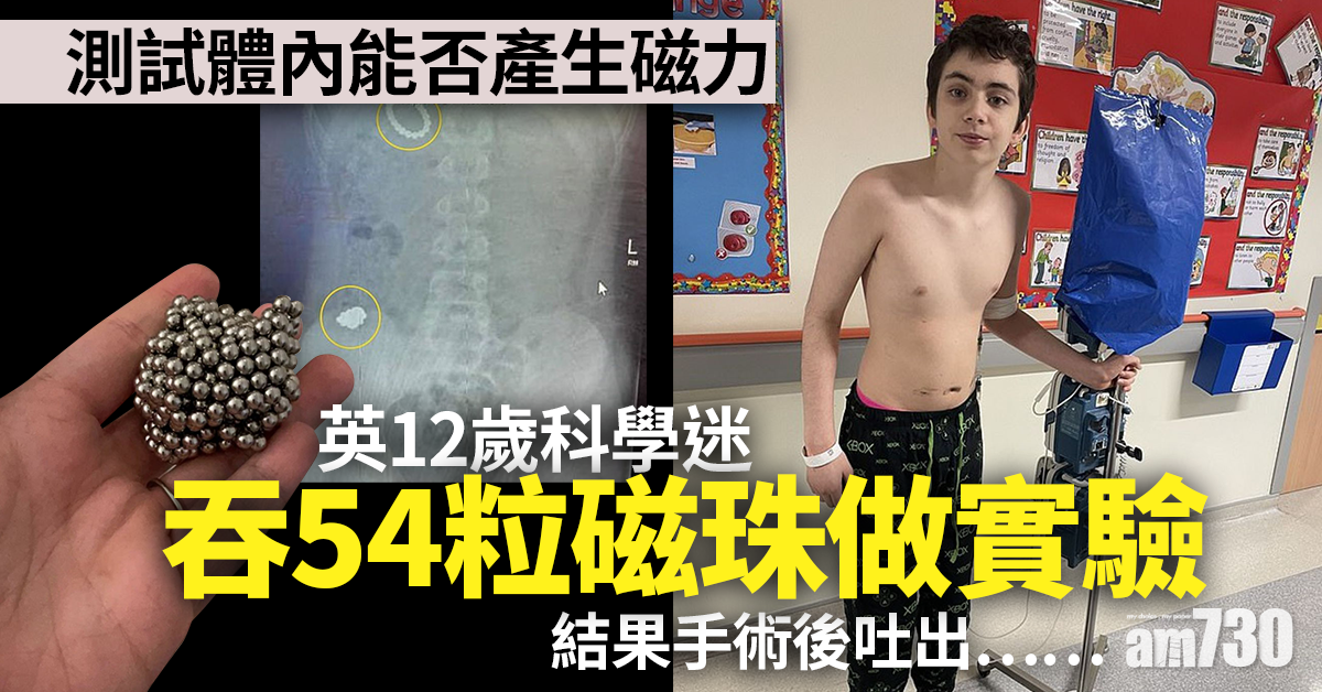 英12歲科學迷吞54粒磁珠做實驗 結果……