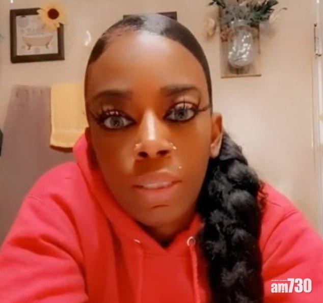 網上熱話｜強力膠水頂替定型噴霧  女子頭髮黐實成個月要搵整形外科醫生解救