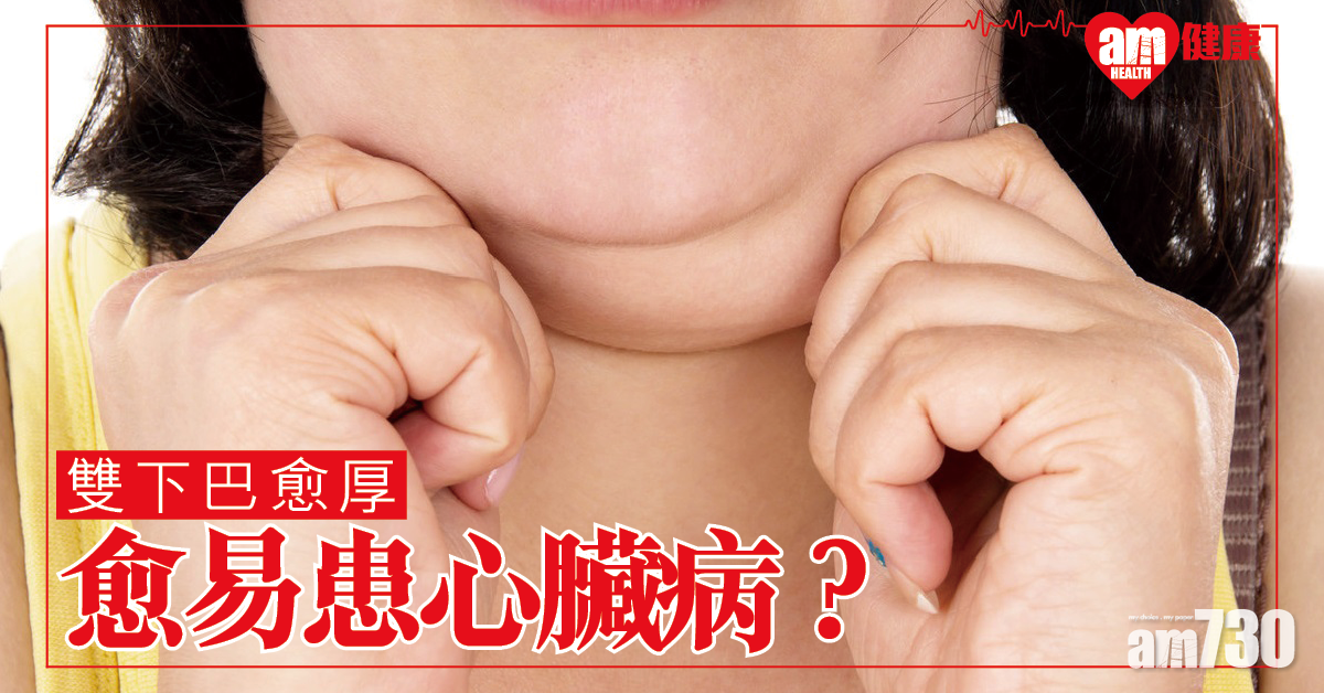 愈厚愈危險 雙下巴或反映更易有心臟病？