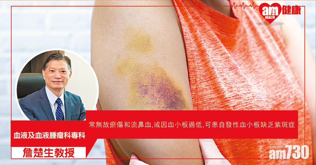 無故瘀傷或血小板低