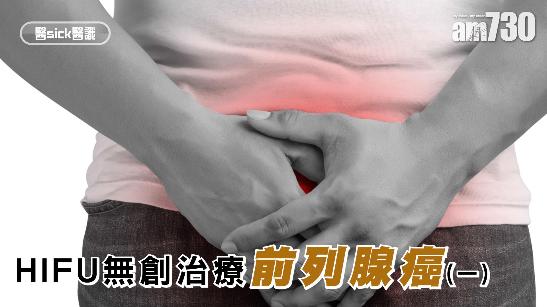 HIFU無創治療前列腺癌(一)