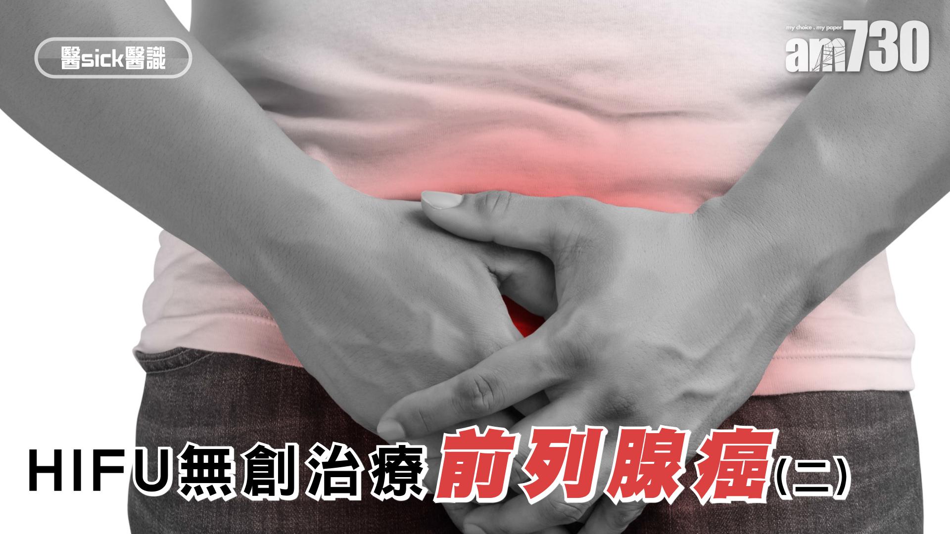 HIFU無創治療前列腺癌(二)