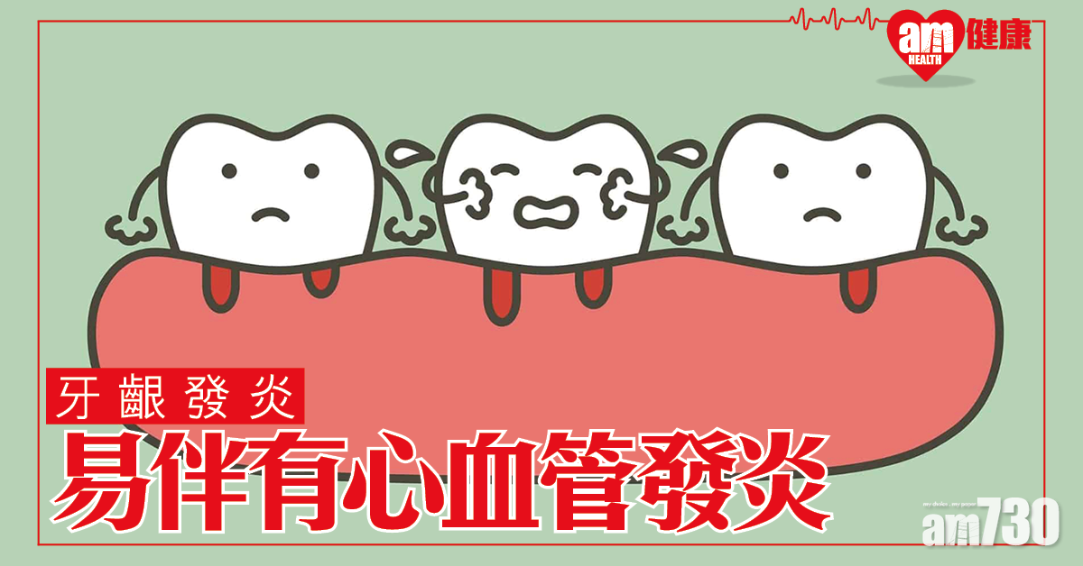 口腔健康│研究：牙周病增心血管病風險