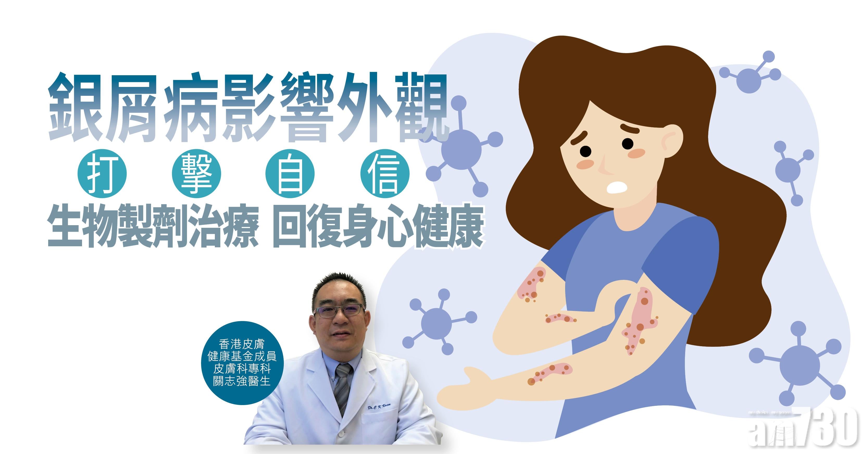 【健康解碼】銀屑病影響外觀 生物製劑治療 回復身心健康