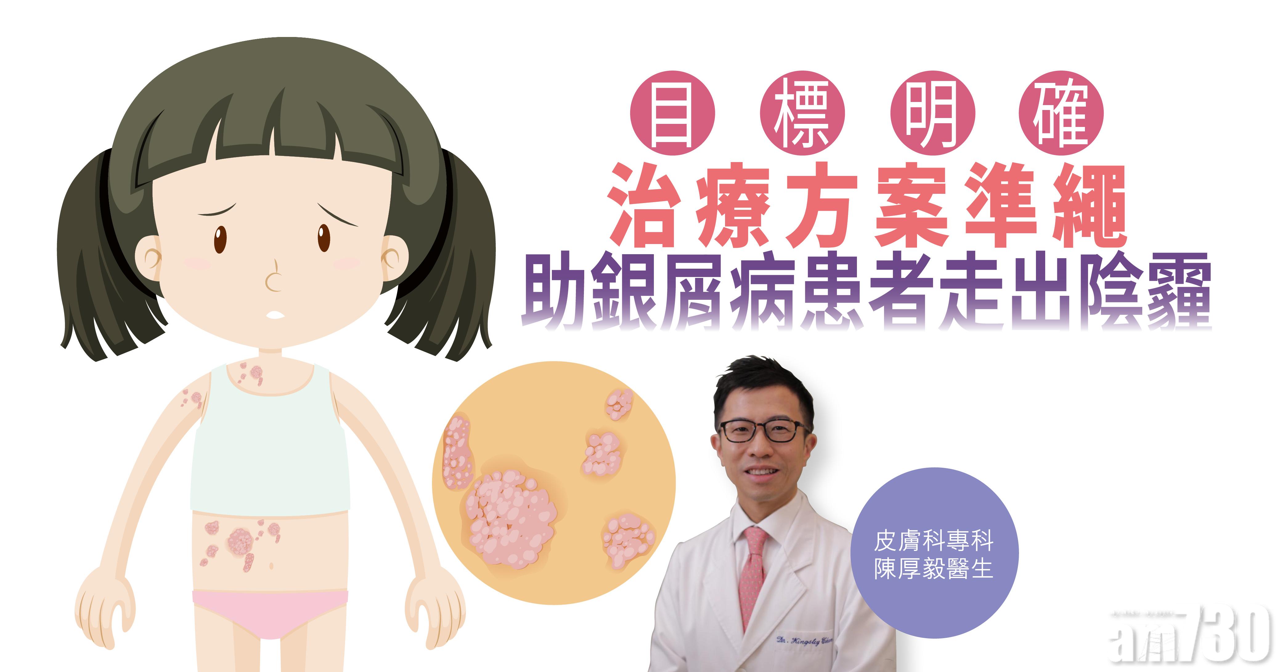 【健康解碼】目標明確 治療方案準繩 助銀屑病患者走出陰霾