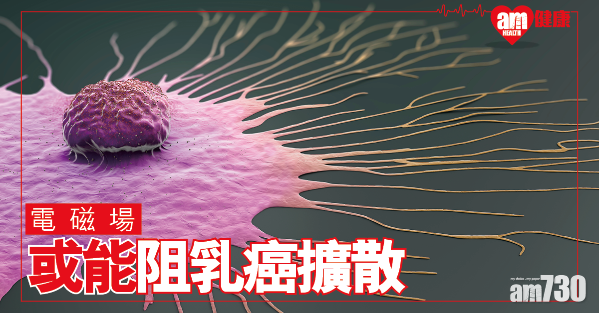 電磁場能緩減乳癌細胞擴散活動 美研：像抽走燃料的汽車