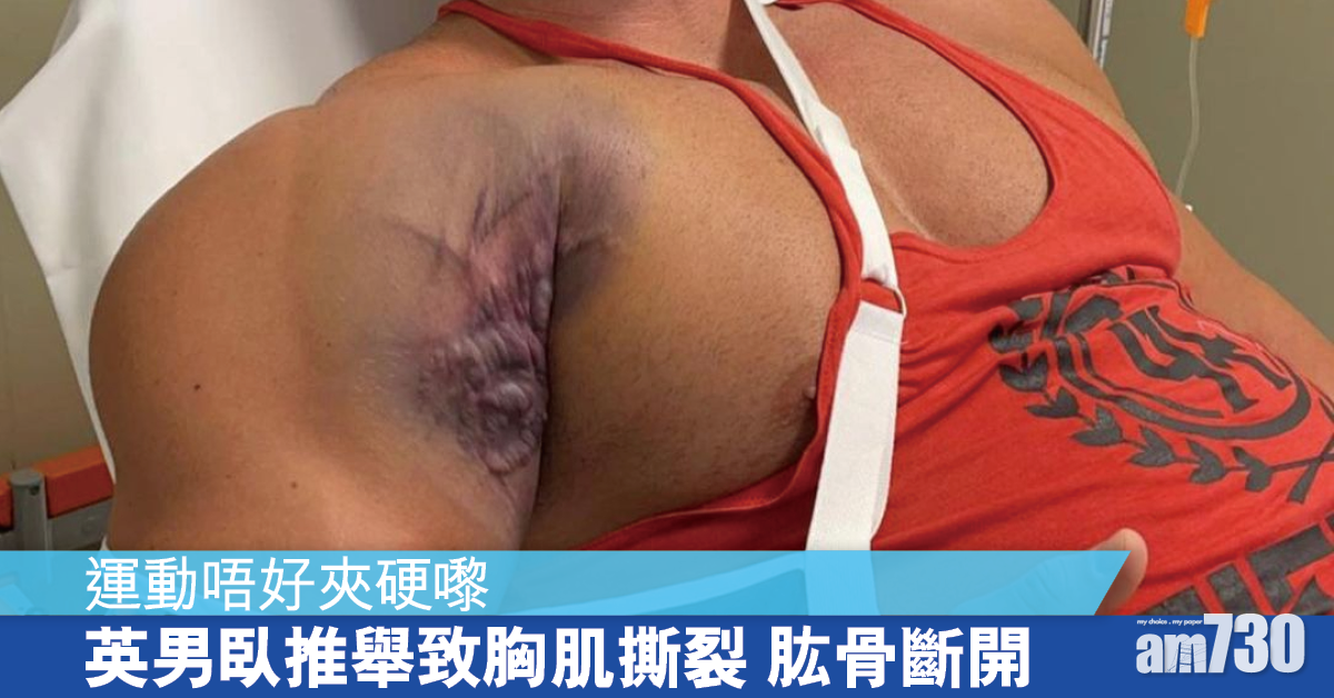 做運動 安全最重要