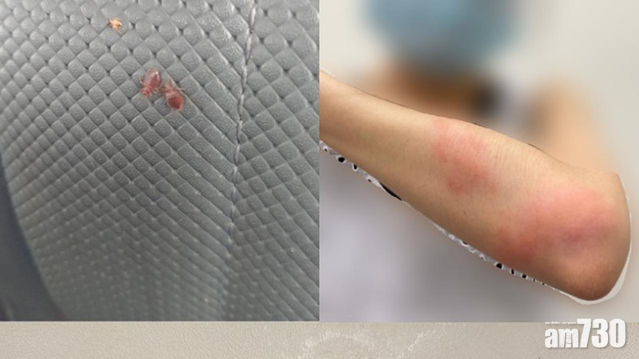 網上熱話｜的士車廂爬滿蟲蝨 乘客中招全身痕癢腫痛