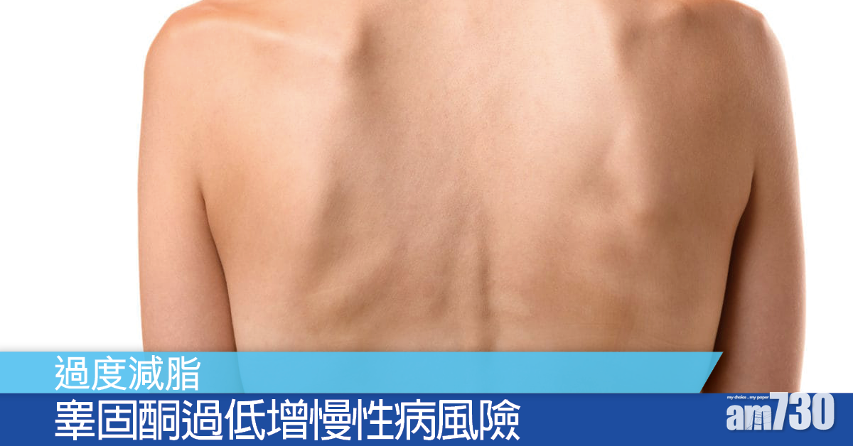 減脂要適當 脂肪過少或增慢性病風險