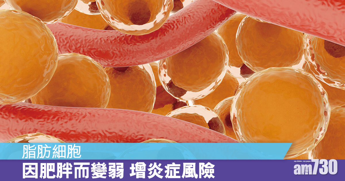 研究：脂肪細胞因肥胖而變弱