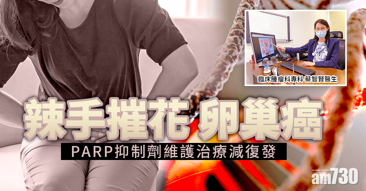 中晚期七成復發 抑制修復阻截卵巢癌重臨