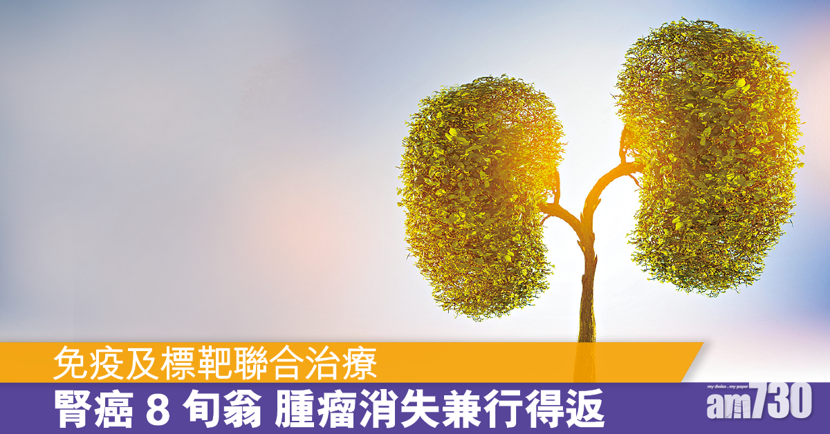 免疫及標靶聯合治療 晚期腎細胞癌療效倍升