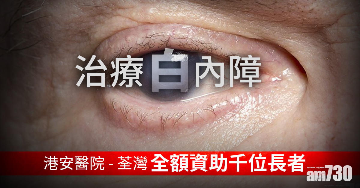 資助低收入長者 治療白內障