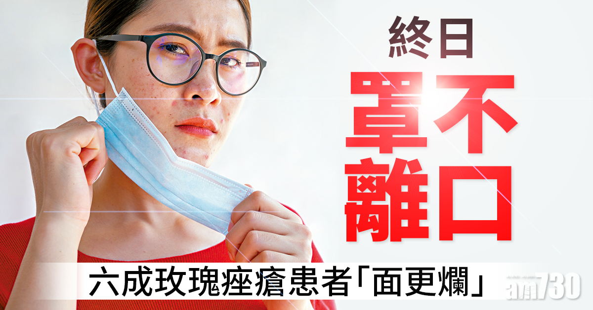 長時間戴口罩 釀玫瑰痤瘡惡性循環