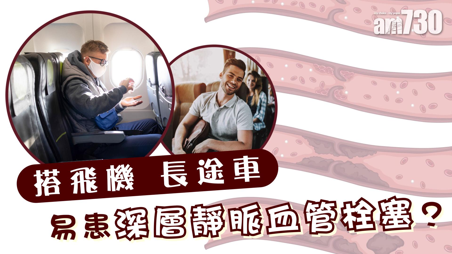 搭飛機 長途車 易患深層靜脈血管栓塞？