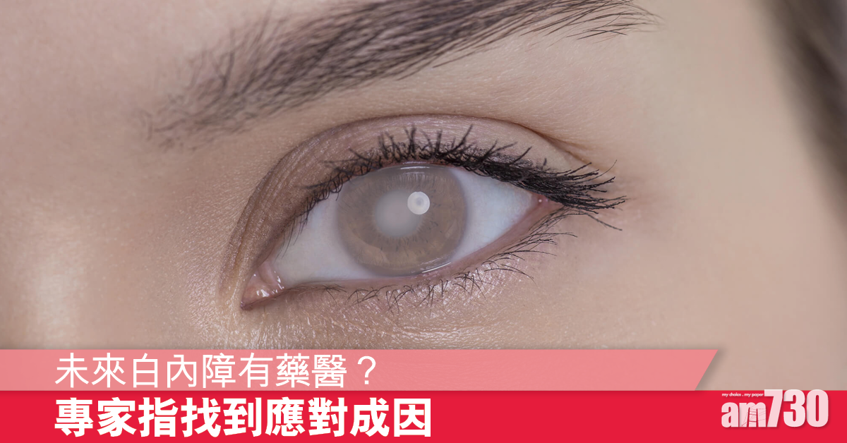 找到白內障的成因 未來或可以藥物代替手術治療