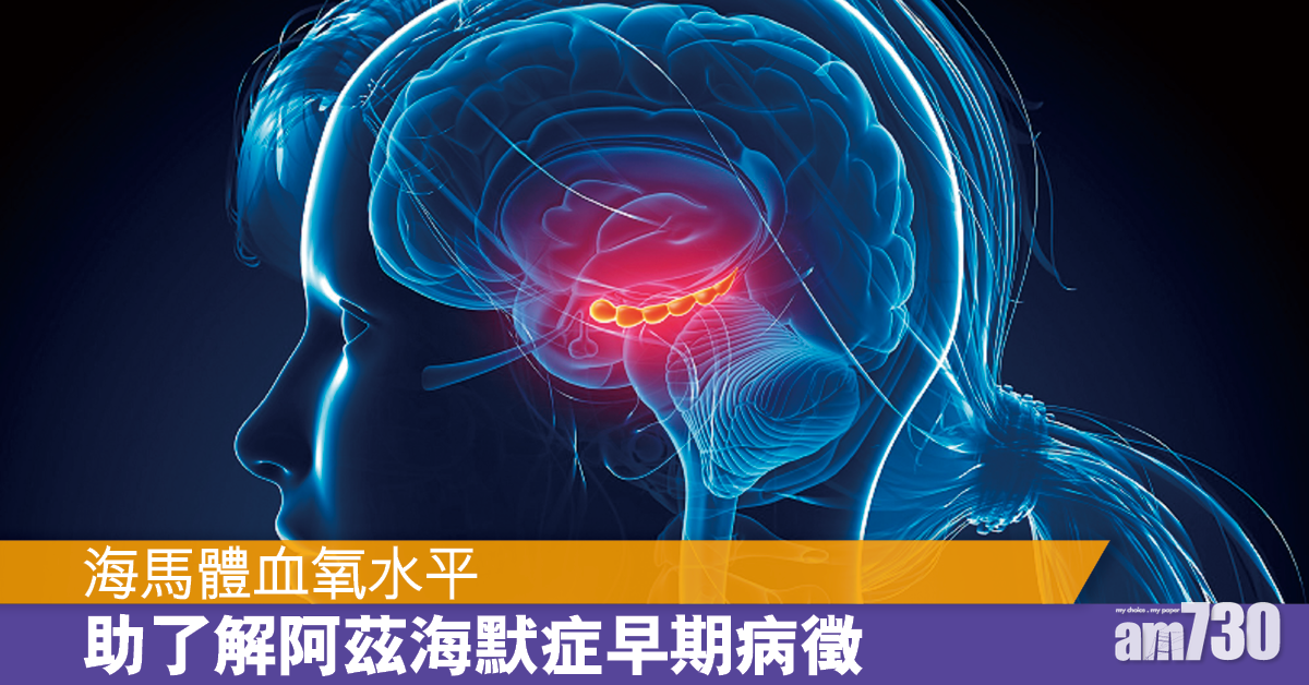 阿茲海默症丨大腦海馬體血氧水平 助了解發病早期病徵