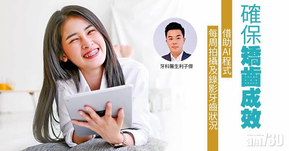 AI輔助確保矯齒成效