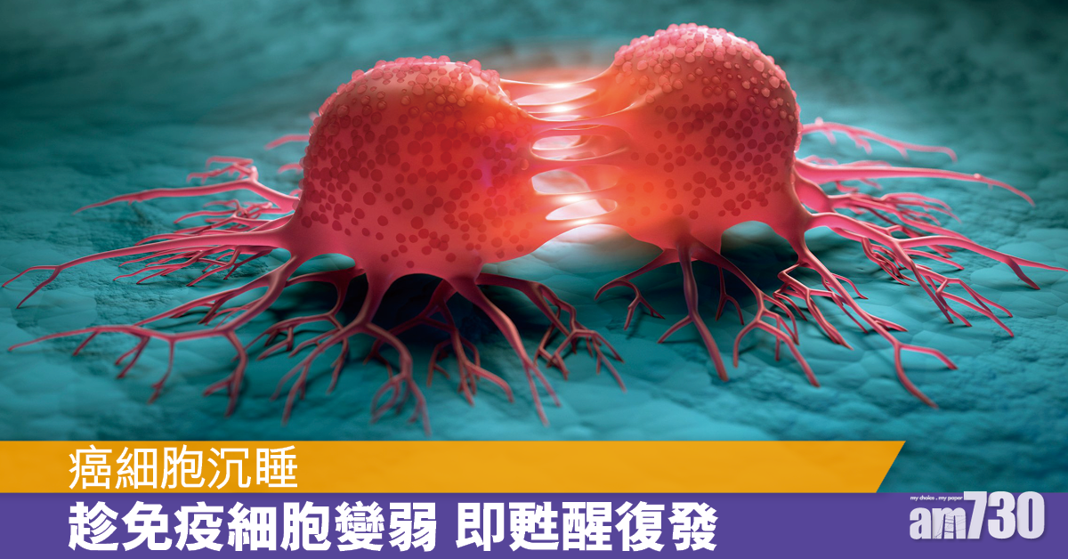 瑞士研究揭癌細胞沉睡伺機復發