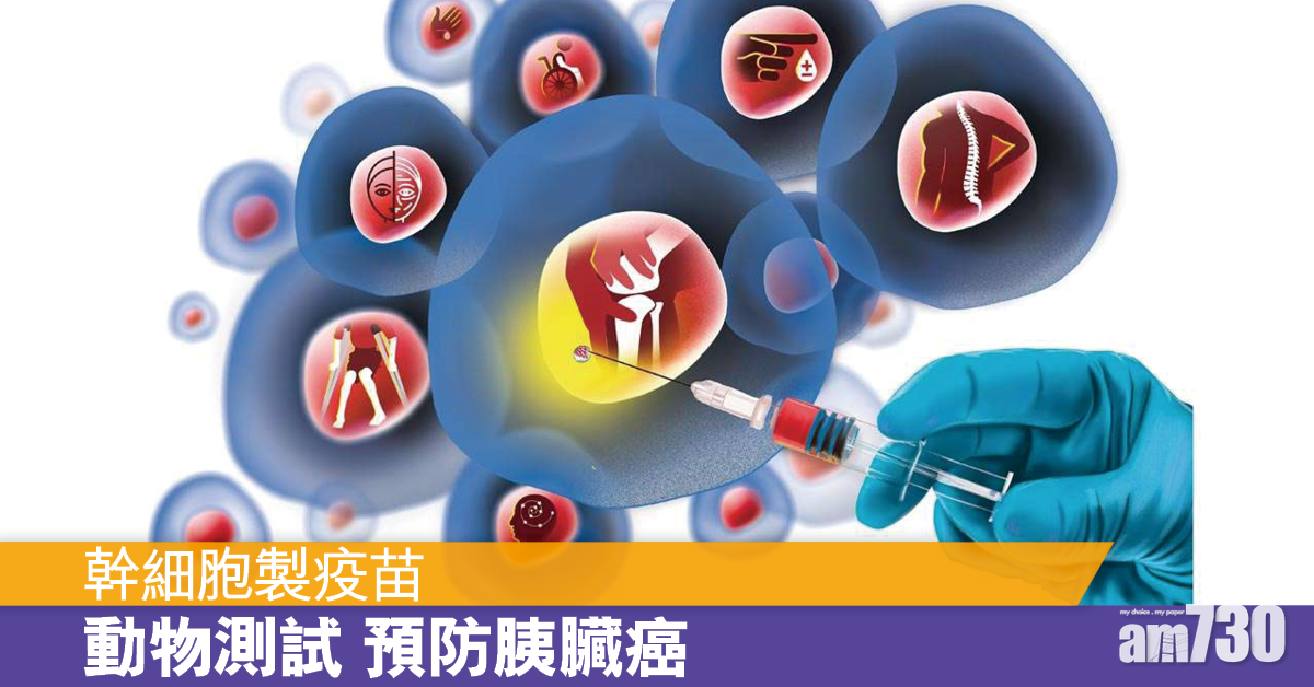 幹細胞製疫苗 或成預防胰臟癌新方法