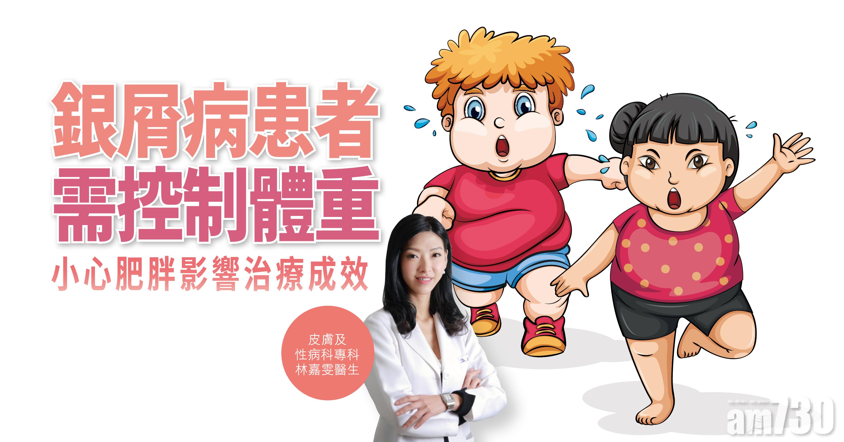 【健康解碼】銀屑病患者需控制體重 小心肥胖影響治療成效