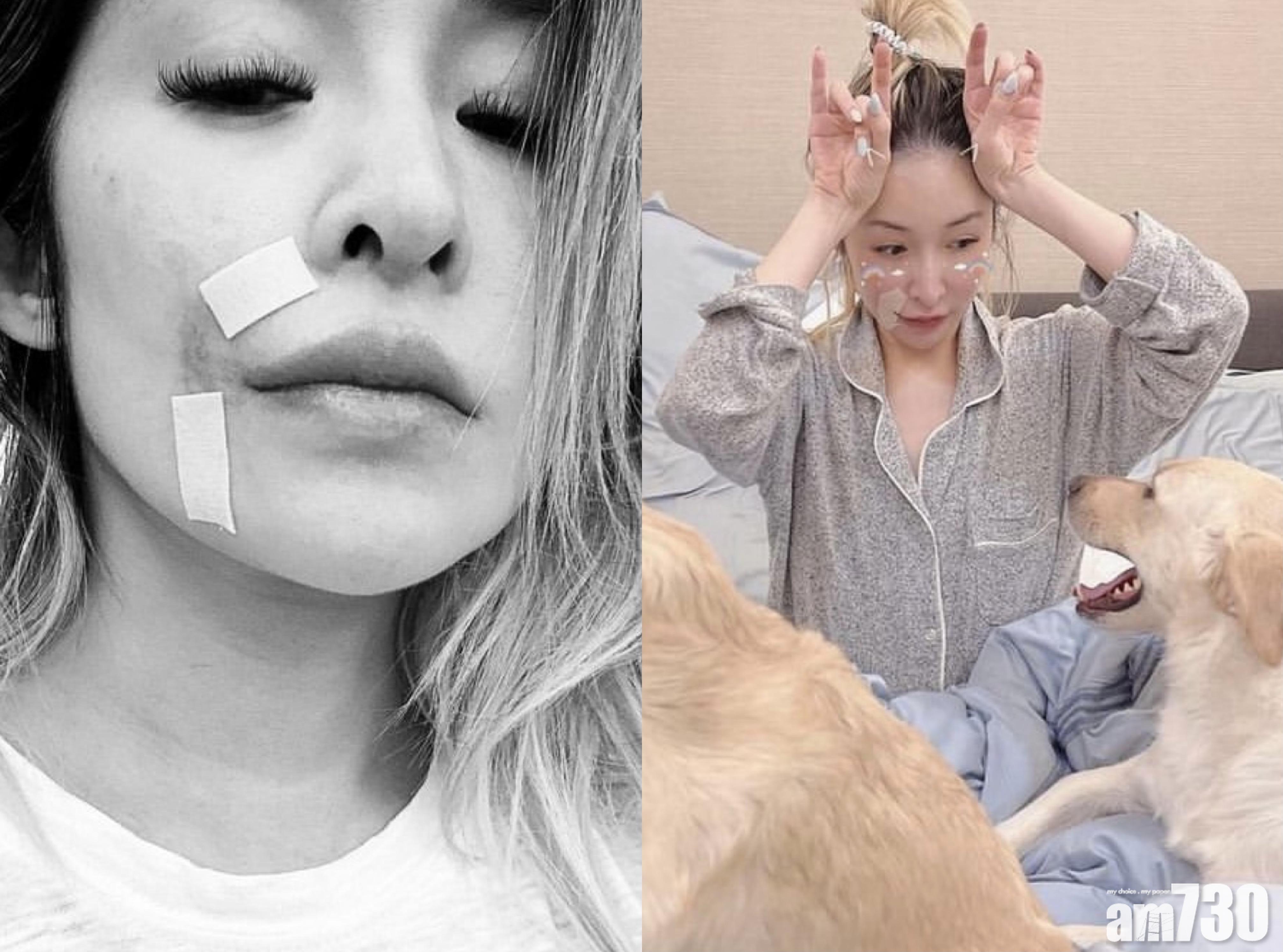 破相半年| 照鏡都想喊　蕭亞軒：不喜歡現在模樣