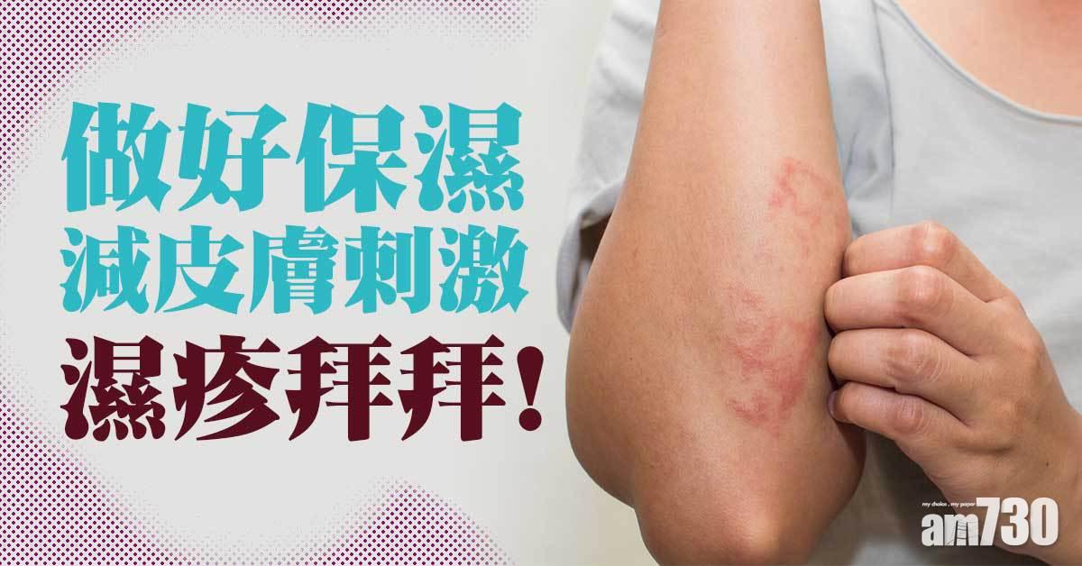 濕疹｜日常生活緊記5大保濕潤膚Tips