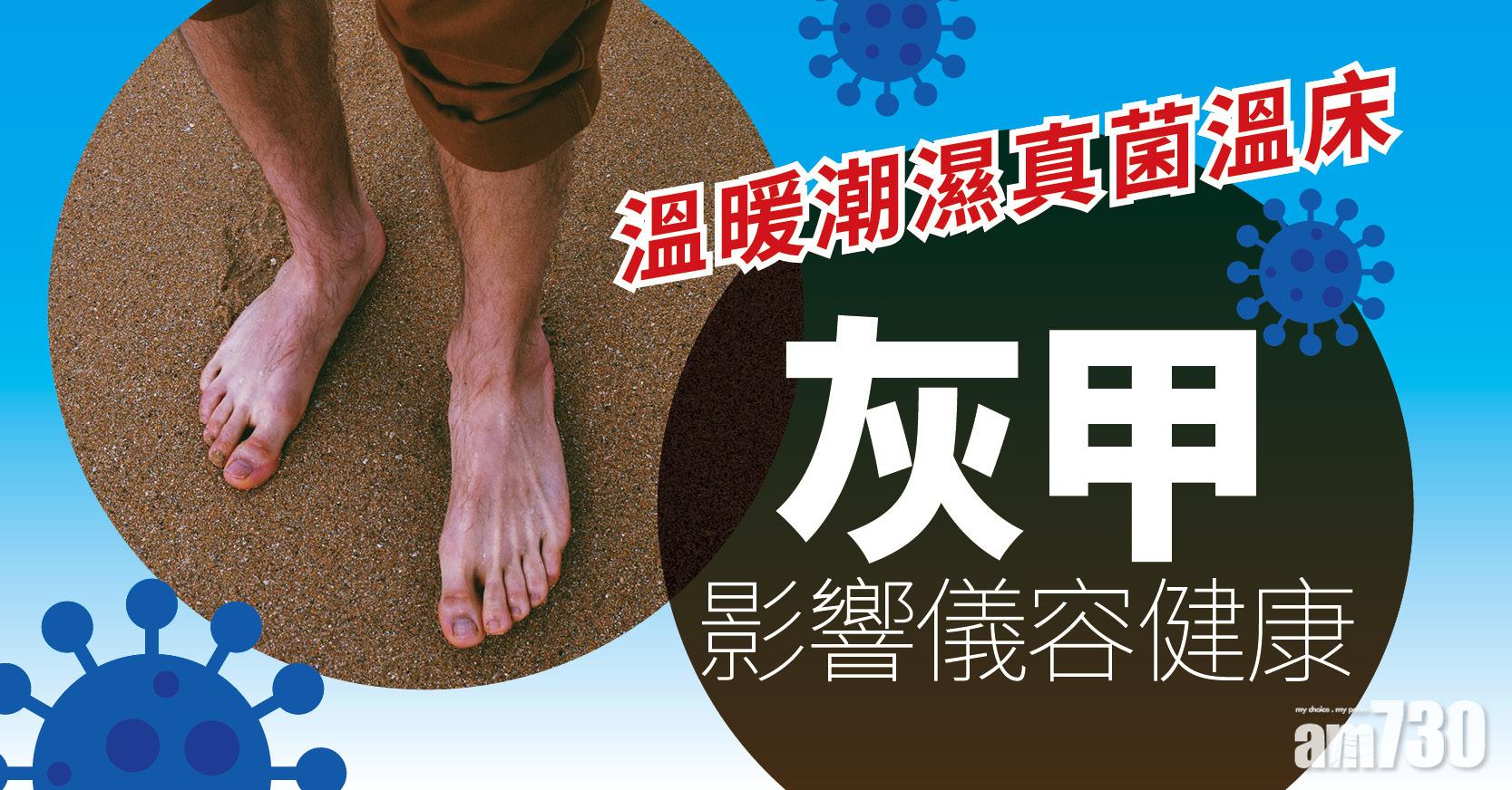 【健康佳】溫暖潮濕真菌溫床 灰甲影響儀容健康